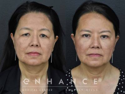 Before and afters - 199