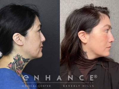 Before and afters - 222