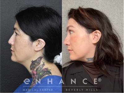 Before and afters - 223