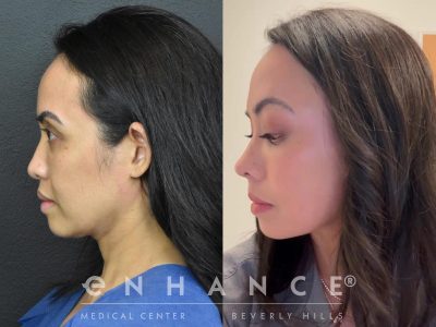 Before and afters - 213