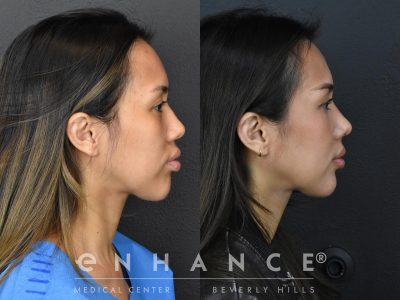 Before and afters - 176