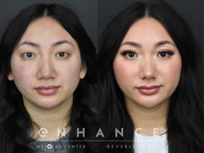 Before and afters - 206