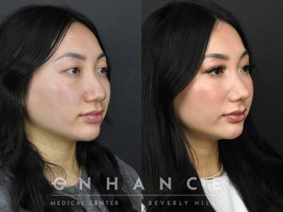 Before and afters - 208