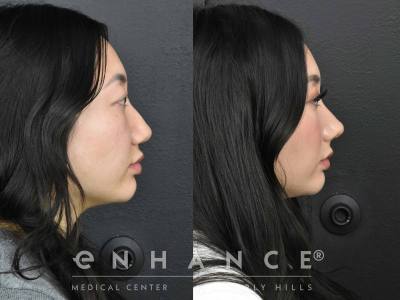 Before and afters - 207