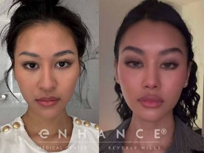 Before and afters - 182