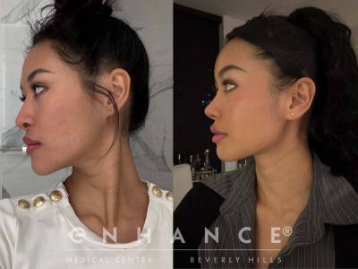 Before and afters - 184
