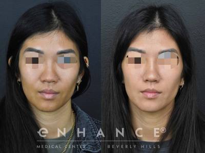 Before and afters - 196