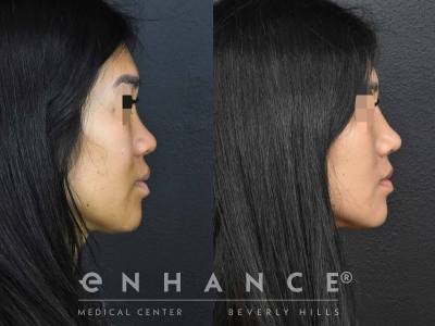 Before and afters - 197