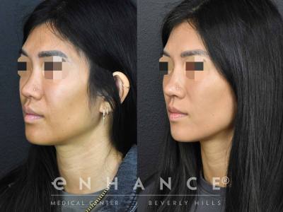 Before and afters - 198