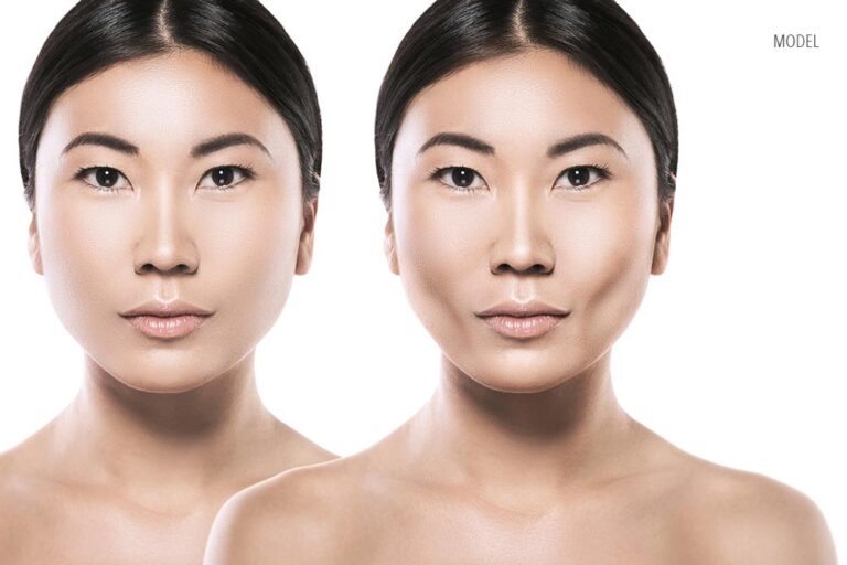 female face comparison after the surgery